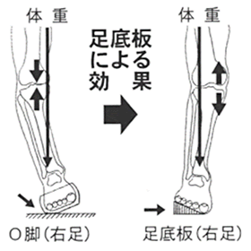 変形性膝関節症の足装具