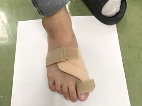 変形性膝関節症の足装具